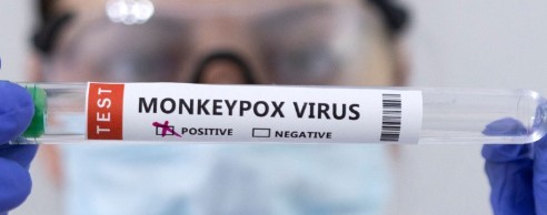 Understanding the Mpox Virus: Key Insights and Implications